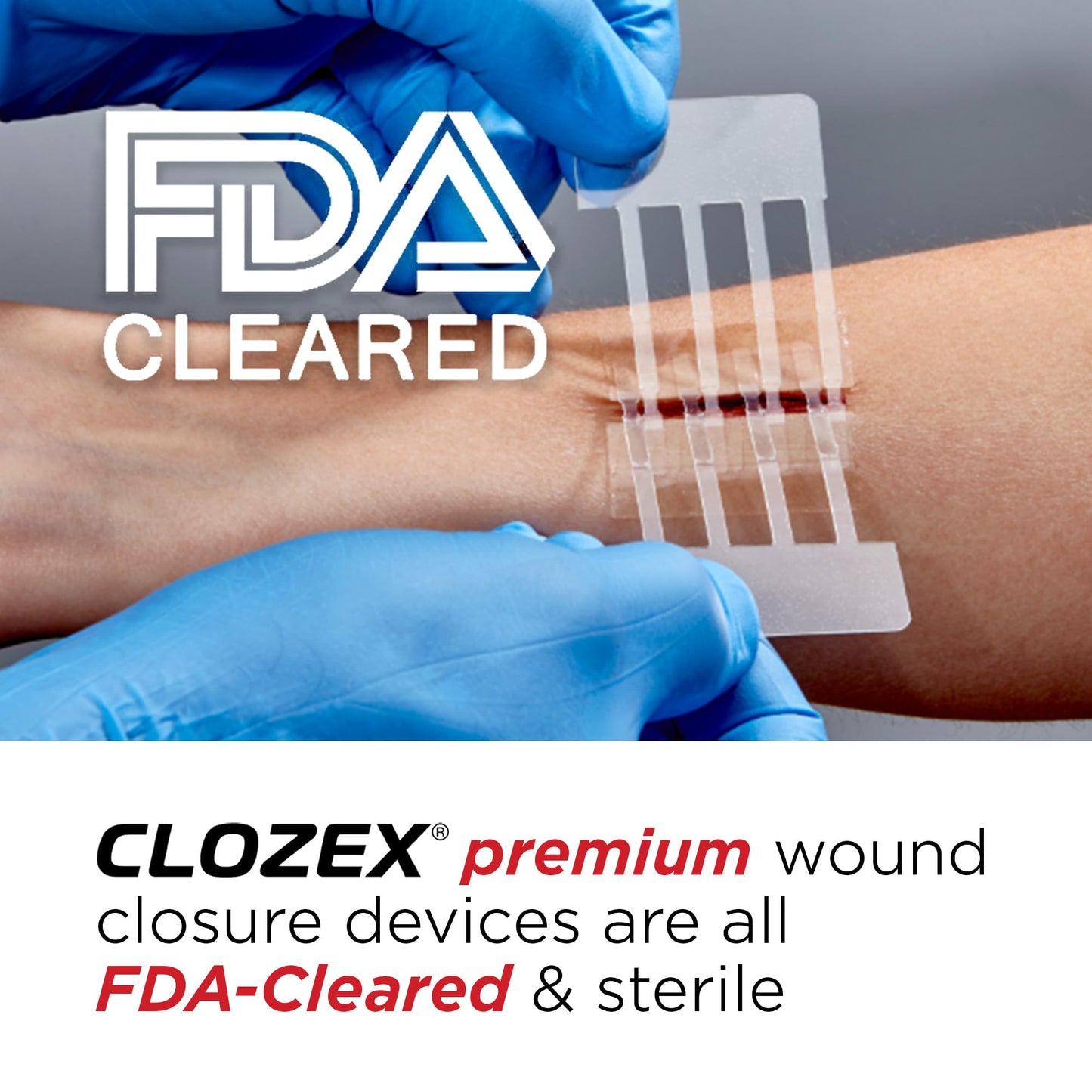 Clozex Emergency Laceration Closure Only- Close Wounds Without Stitches with This Surgical-Grade Skin Device. Available in 3 Variations for Wounds up to 1.0” or 3.5”. Life Happens, Be Ready!